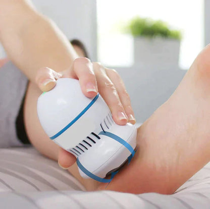 Beauty Bloom Vacuum Callus Remover